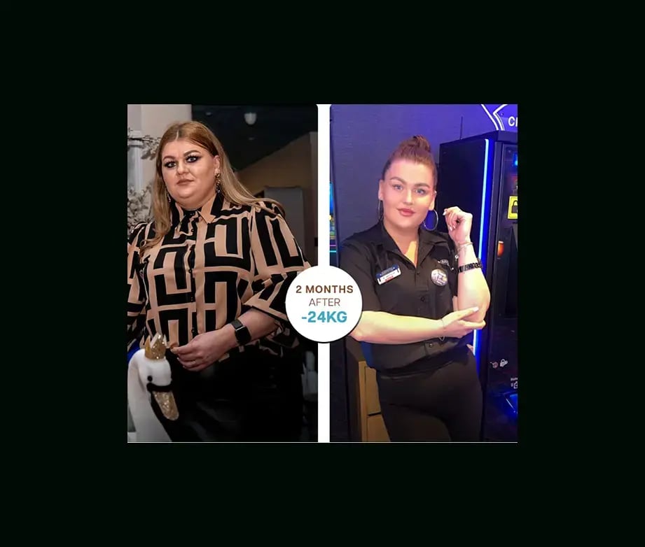 apera-gastric-sleeve-before-after-28