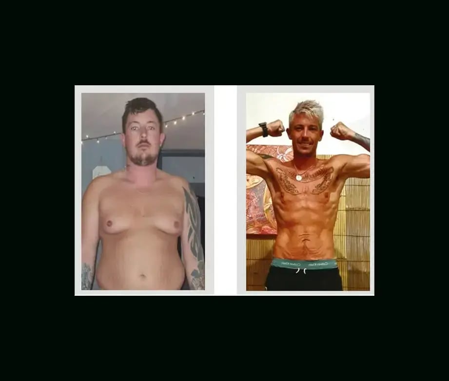 apera-gastric-sleeve-before-after-55
