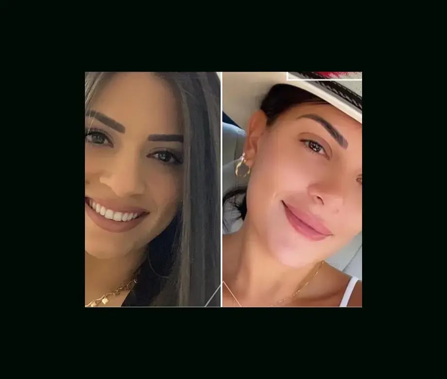 hakan-bulam-md-rhinoplasty-before-after-1-1