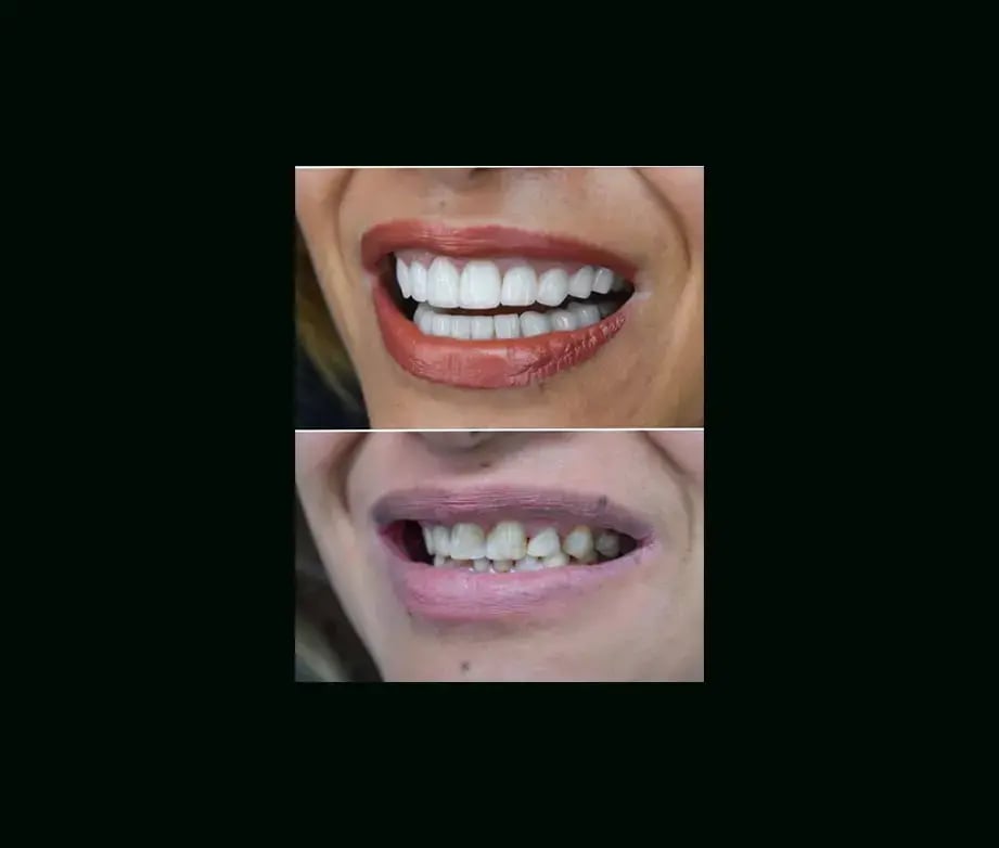 istadental-before-after-1