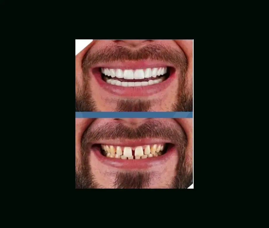 istadental-before-after-10