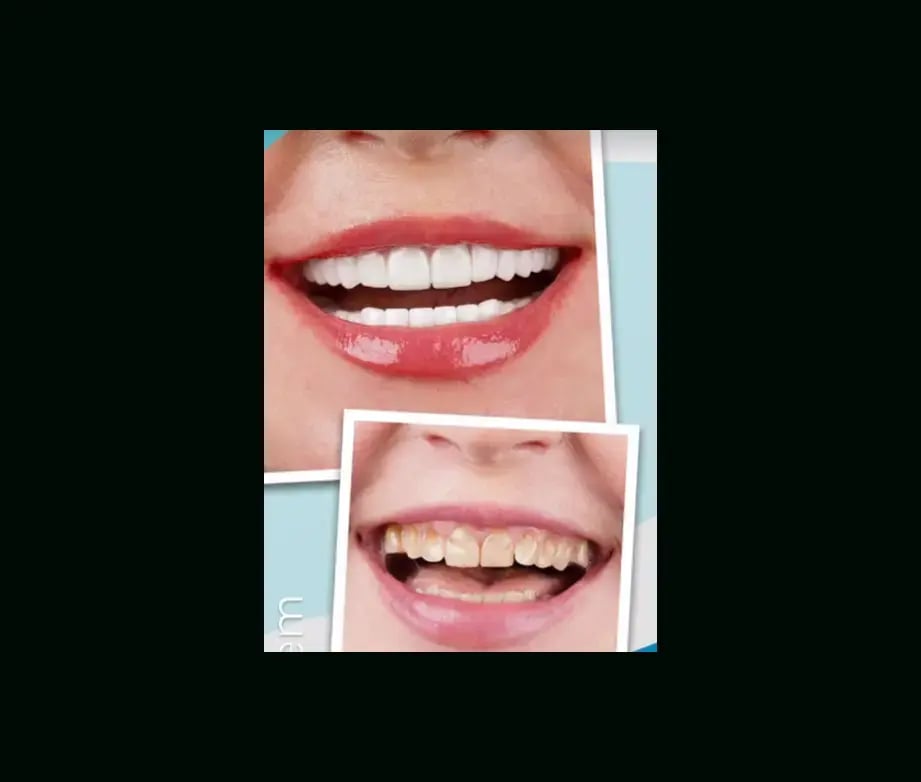 istadental-before-after-11