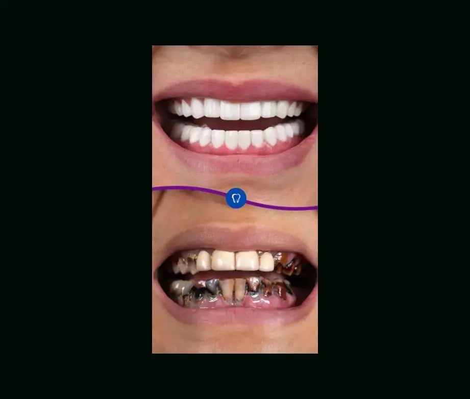 istadental-before-after-14