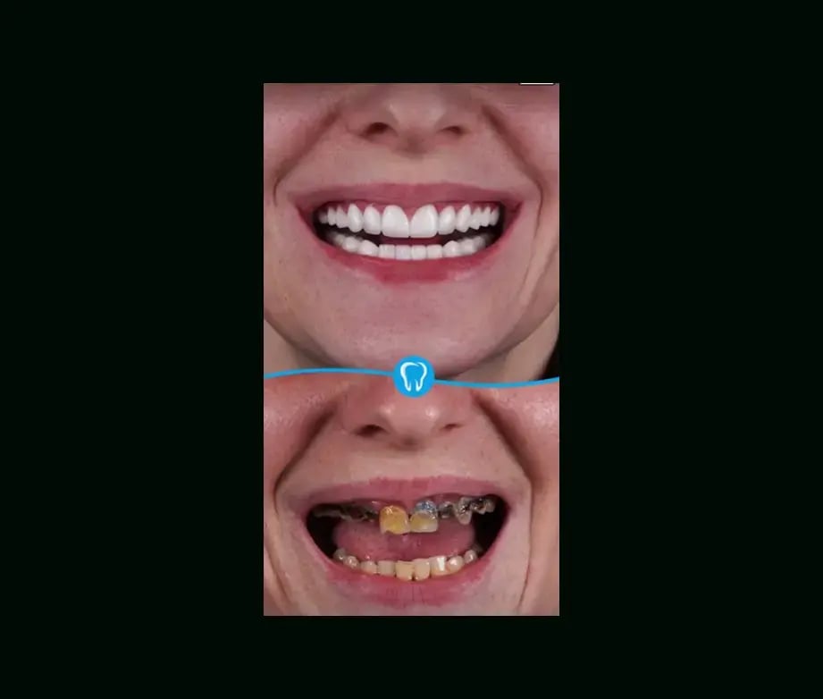 istadental-before-after-16