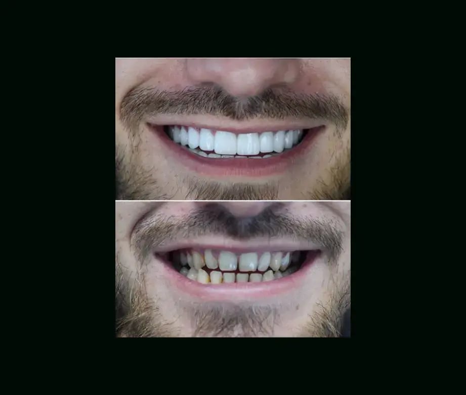 istadental-before-after-2