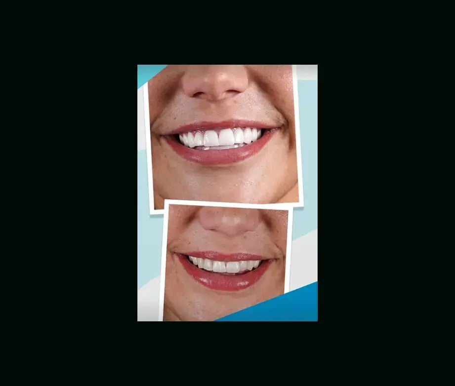 istadental-before-after-5