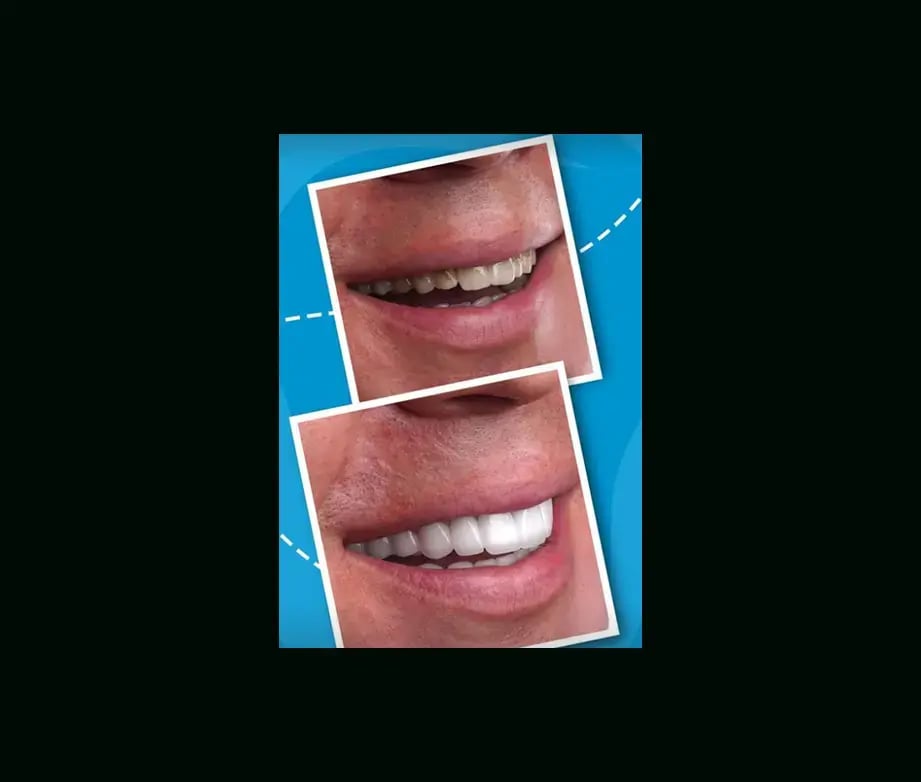 istadental-before-after-7