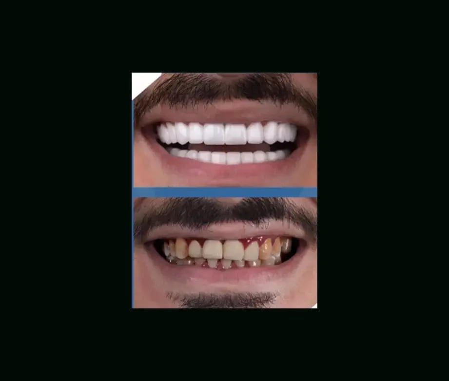 istadental-before-after-8