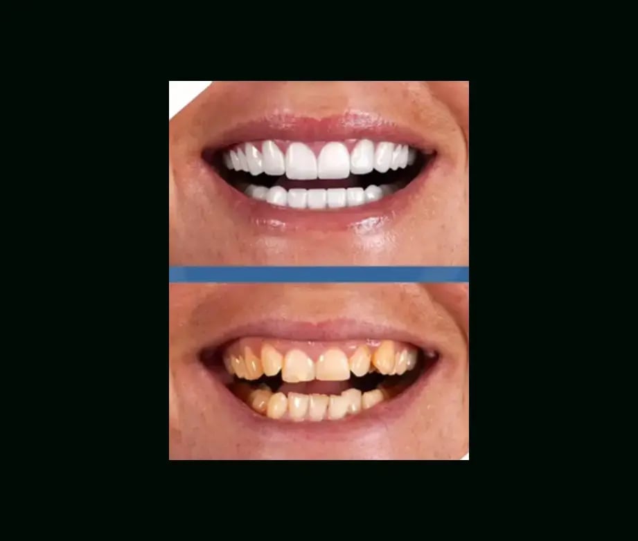 istadental-before-after-9