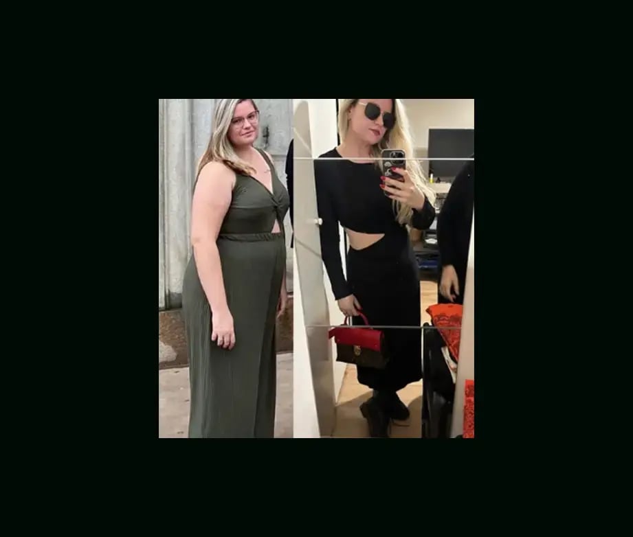 mustafa-atabey-md-gastric-sleeve-before-after-1