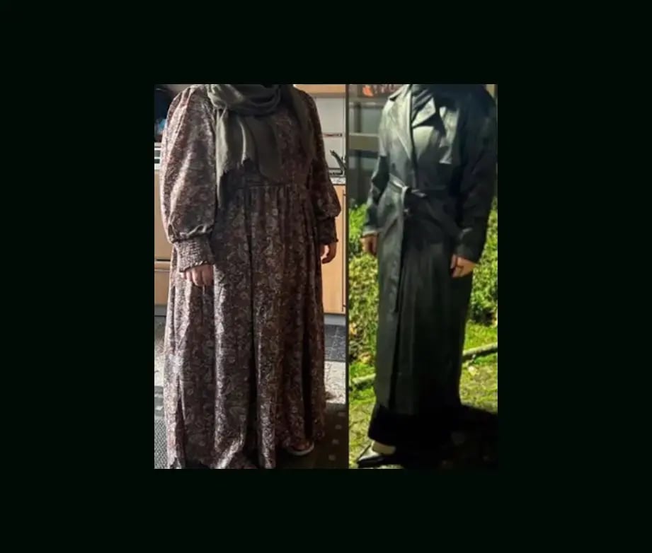 mustafa-atabey-md-gastric-sleeve-before-after-11