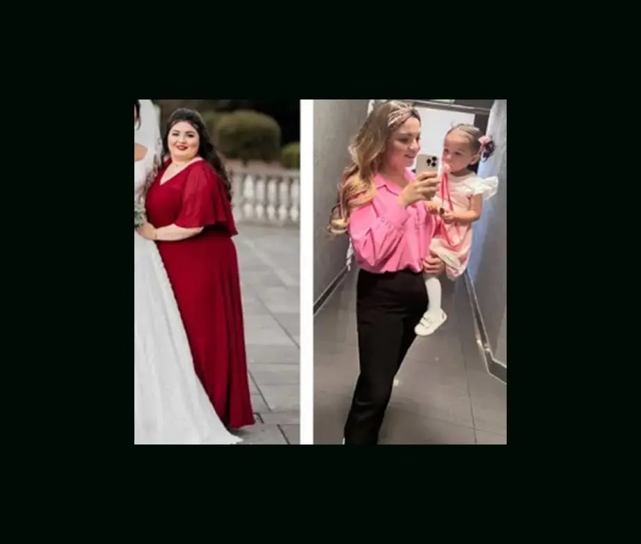 mustafa-atabey-md-gastric-sleeve-before-after-13