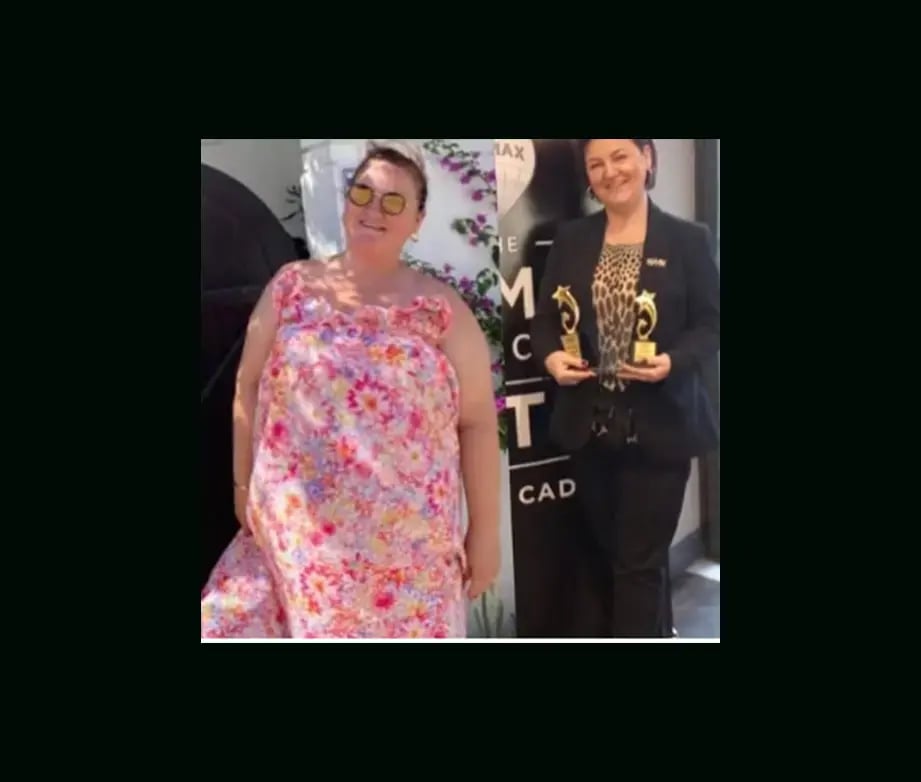 mustafa-atabey-md-gastric-sleeve-before-after-15