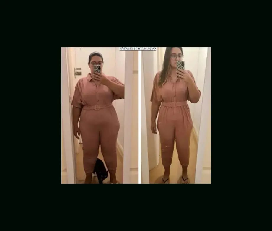 mustafa-atabey-md-gastric-sleeve-before-after-2