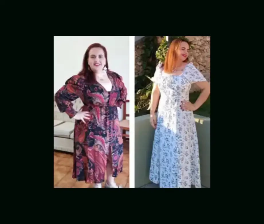 mustafa-atabey-md-gastric-sleeve-before-after-29