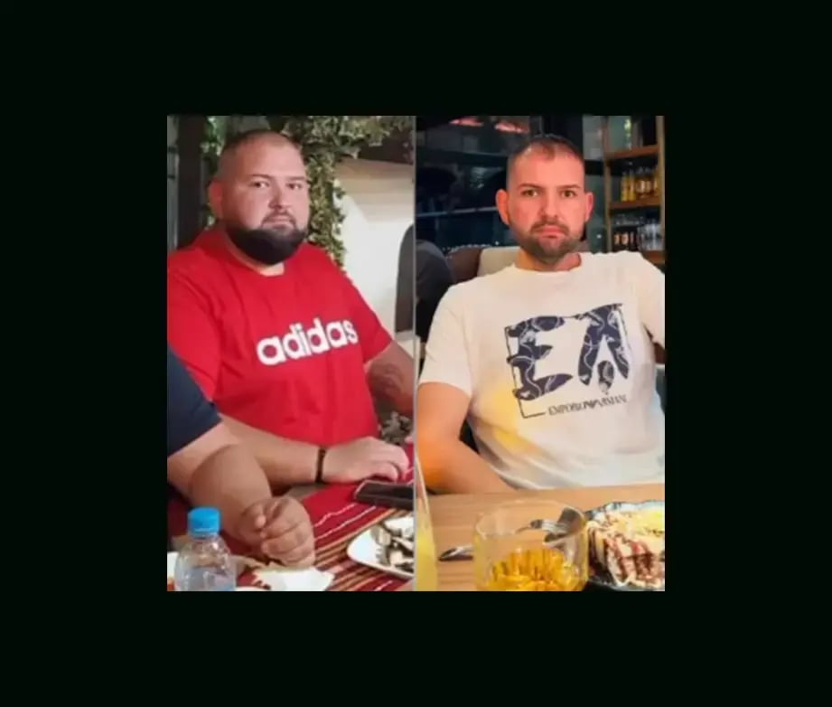 mustafa-atabey-md-gastric-sleeve-before-after-30