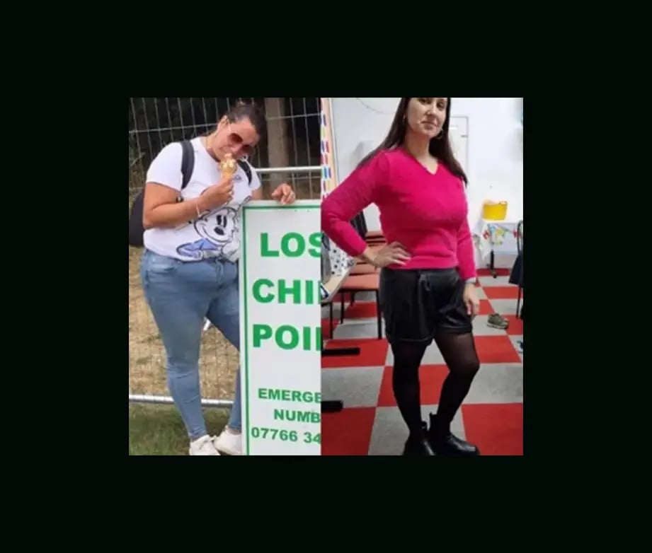 mustafa-atabey-md-gastric-sleeve-before-after-4