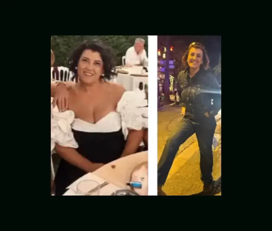 mustafa-atabey-md-gastric-sleeve-before-after-40