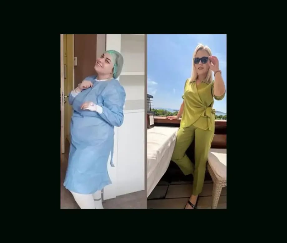 mustafa-atabey-md-gastric-sleeve-before-after-41