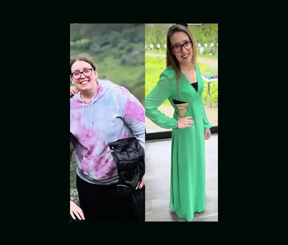 mustafa-atabey-md-gastric-sleeve-before-after-48