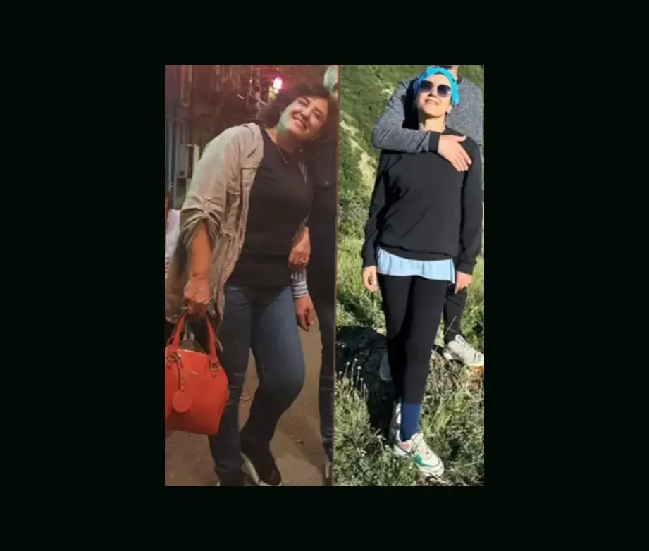 mustafa-atabey-md-gastric-sleeve-before-after-52