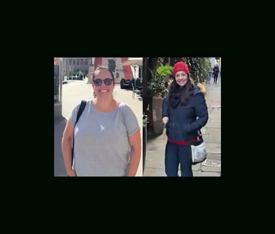 mustafa-atabey-md-gastric-sleeve-before-after-6