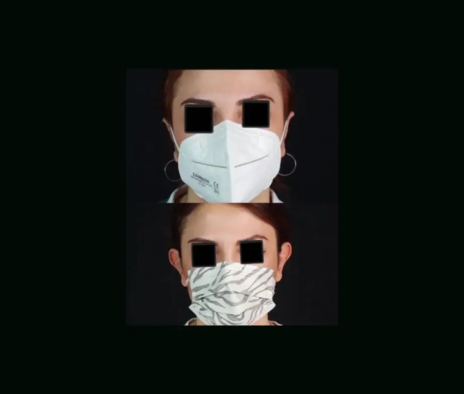tugce-simsek-md-ear-surgery-before-after-10-1